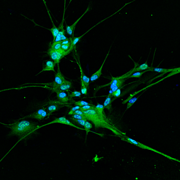 Immunostaining (in green) for the Ca2+ activated chloride channel TMEM16B on patient derived glioma stem cells. The blue color identifies nuclei. Credits: Francesca Cesca, University of Trieste