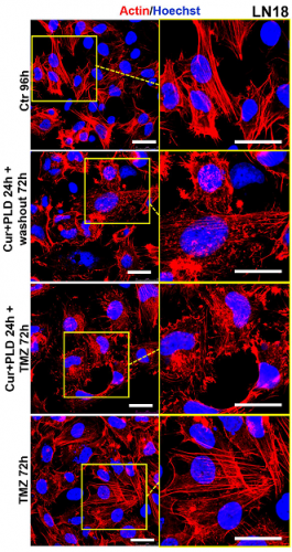 Effetti in presenza o meno del pretrattamento con curcumina e polidatina sulle cellule tumorali di glioblastioma trattate con temozolomide